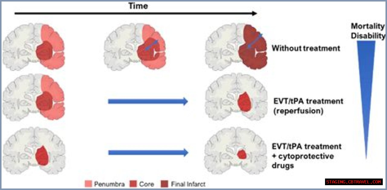 Understanding Peter Griffin Stroke: A Comprehensive Analysis